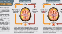 La dislexia a diferencia de otros trastornos no tiene un área específica dentro del cerebro y se descubre casi siempre cuando se inicia el proceso de aprendizaje de la lectoescritura. […]