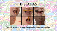 Las praxias buco-faciales son los movimientos que ayudan a ejercitar  y trabajar todos los órganos (boca, labios, lengua, etc) que intervienen en la articulación de los fonemas. Permite al alumno mejorar la […]